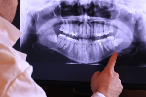 Best Emergency Treatment for Dental Infections or Abscesses in Depoe Bay, OR